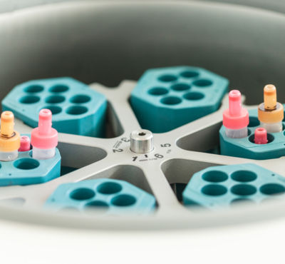 Einblicke in das Labor des Klinikum Döbeln Einblicke in das Labor des Klinikum Döbeln